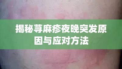 揭秘荨麻疹夜晚突发原因与应对方法