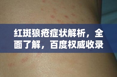 红斑狼疮症状解析，全面了解，百度权威收录